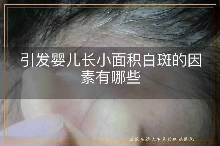 引发婴儿长小面积白斑的因素有哪些