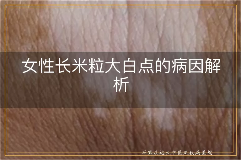 女性长米粒大白点的病因解析
