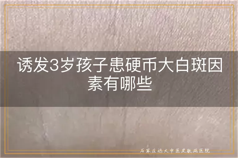 诱发3岁孩子患硬币大白斑因素有哪些