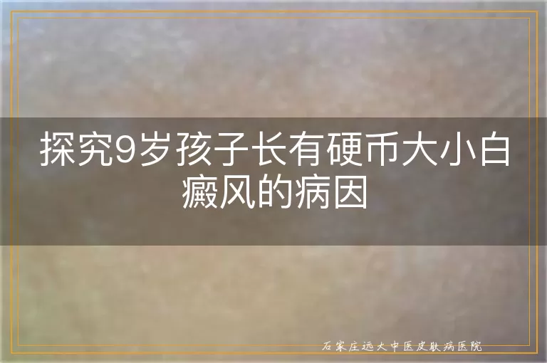 探究9岁孩子长有硬币大小白癜风的病因