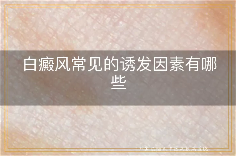 白癜风常见的诱发因素有哪些