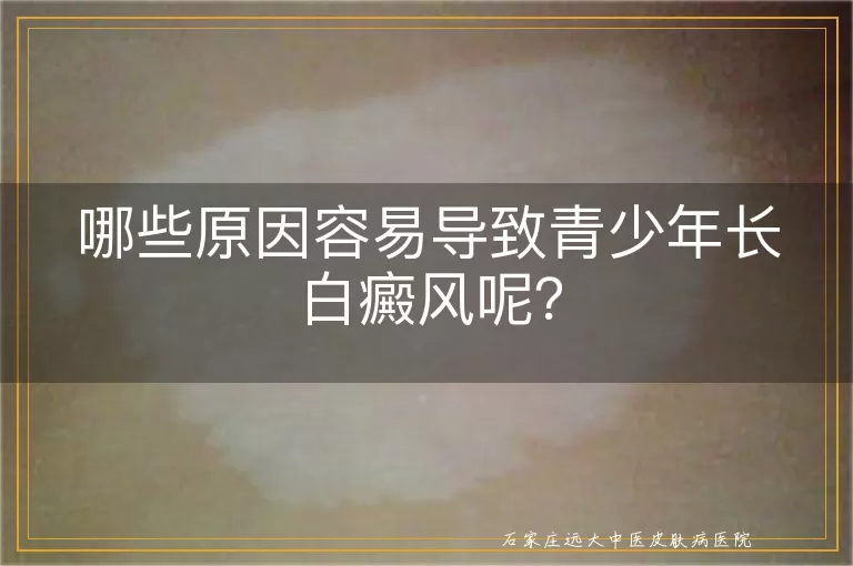 哪些原因容易导致青少年长白癜风呢？