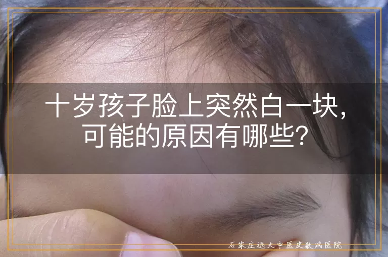 十岁孩子脸上突然白一块，可能的原因有哪些？