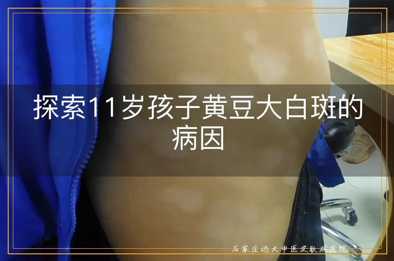 探索11岁孩子黄豆大白斑的病因