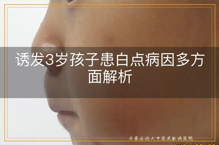 诱发3岁孩子患白点病因多方面解析