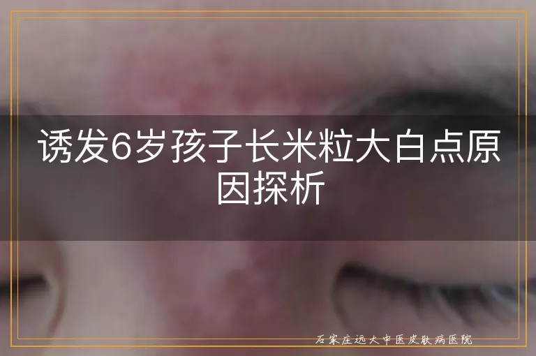 诱发6岁孩子长米粒大白点原因探析