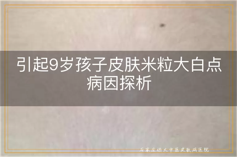 引起9岁孩子皮肤米粒大白点病因探析