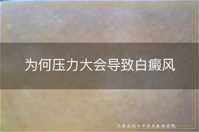 为何压力大会导致白癜风