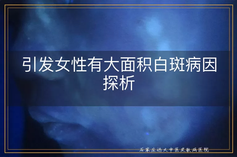 引发女性有大面积白斑病因探析