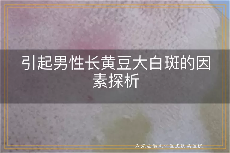 引起男性长黄豆大白斑的因素探析