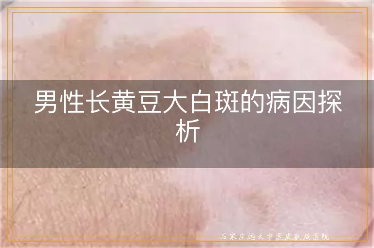 男性长黄豆大白斑的病因探析
