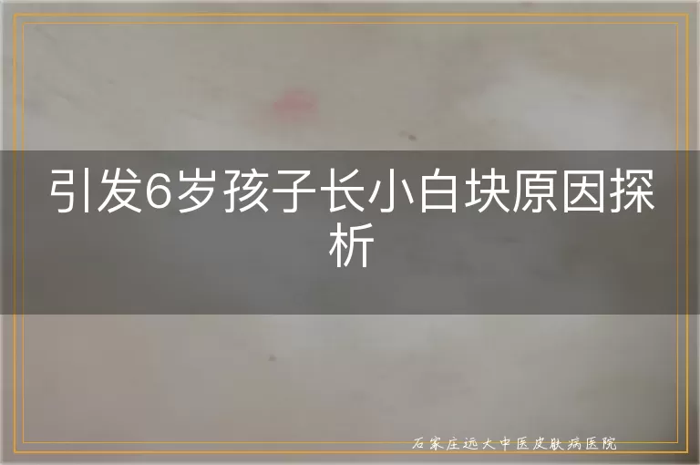 引发6岁孩子长小白块原因探析