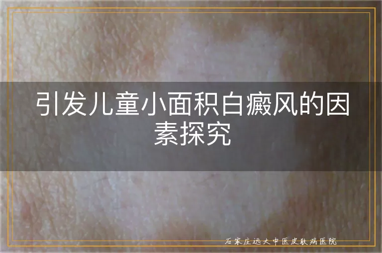 引发儿童小面积白癜风的因素探究