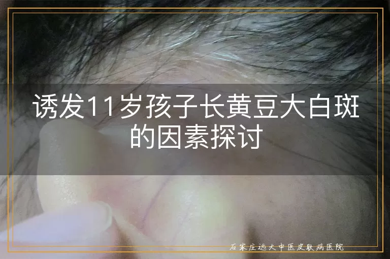 诱发11岁孩子长黄豆大白斑的因素探讨