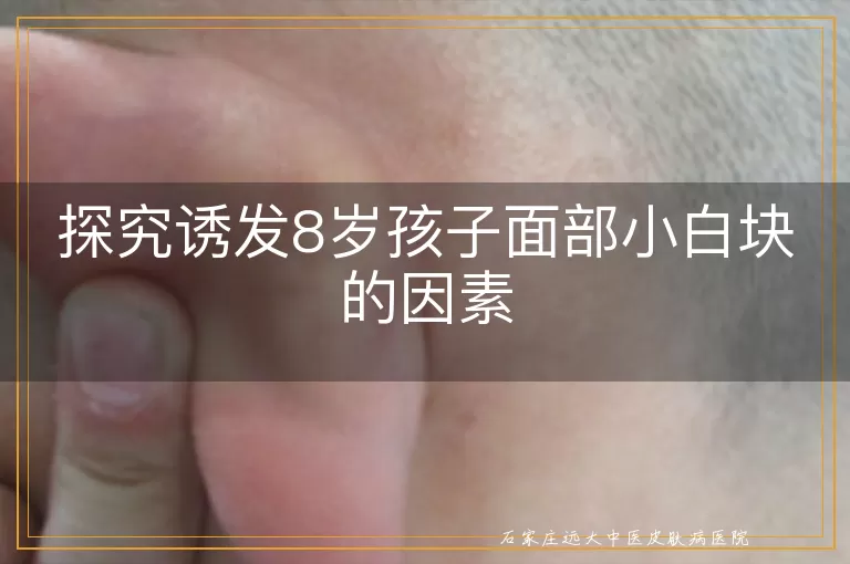 探究诱发8岁孩子面部小白块的因素
