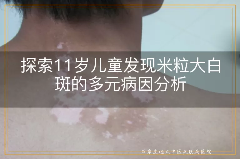 探索11岁儿童发现米粒大白斑的多元病因分析