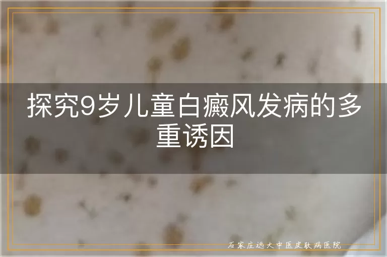 探究9岁儿童白癜风发病的多重诱因