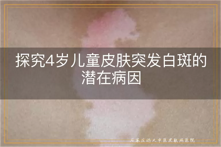 探究4岁儿童皮肤突发白斑的潜在病因