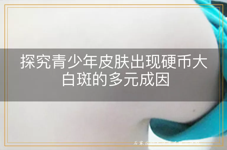 探究青少年皮肤出现硬币大白斑的多元成因