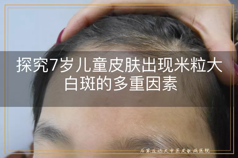 探究7岁儿童皮肤出现米粒大白斑的多重因素