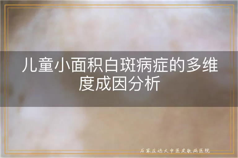 儿童小面积白斑病症的多维度成因分析