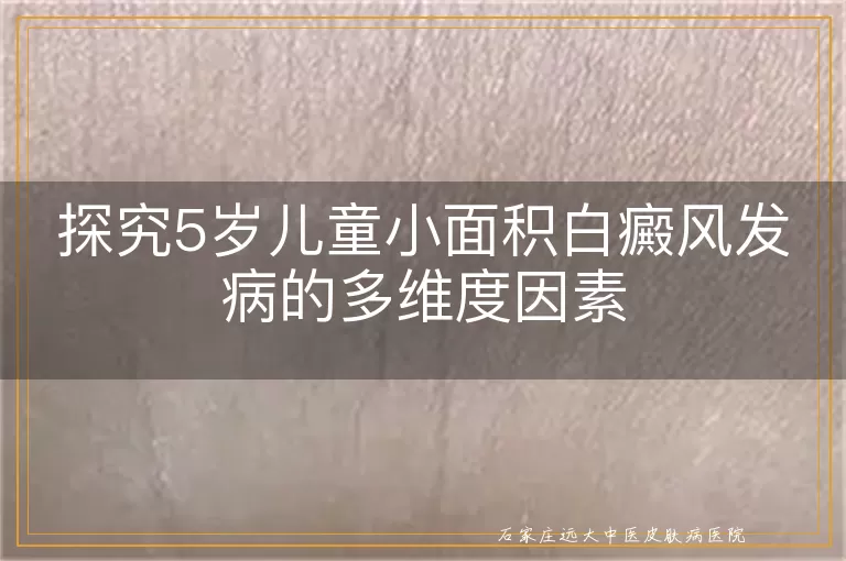 探究5岁儿童小面积白癜风发病的多维度因素