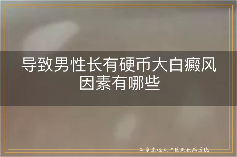 导致男性长有硬币大白癜风因素有哪些