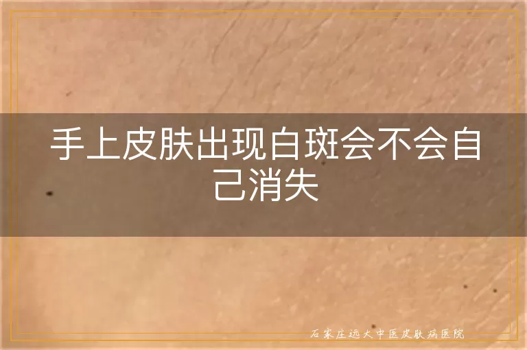 手上皮肤出现白斑会不会自己消失