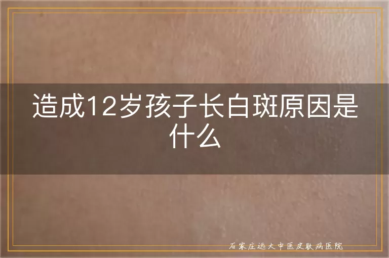 造成12岁孩子长白斑原因是什么