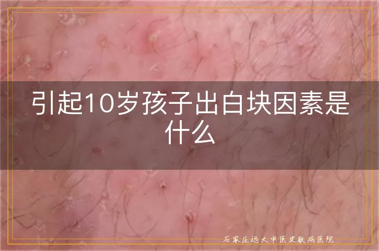 引起10岁孩子出白块因素是什么