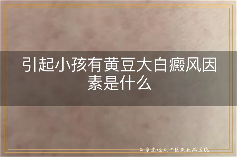引起小孩有黄豆大白癜风因素是什么