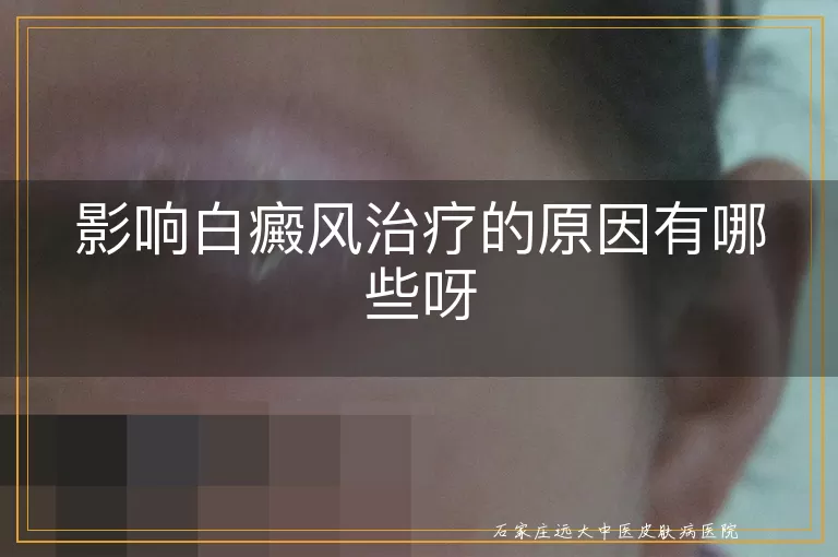 影响白癜风治疗的原因有哪些呀