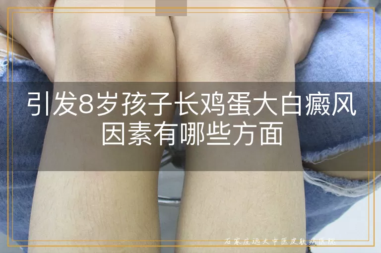 引发8岁孩子长鸡蛋大白癜风因素有哪些方面