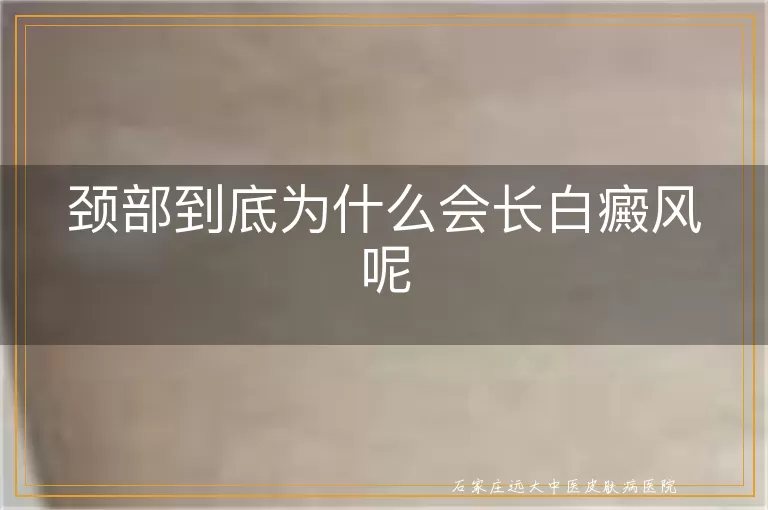 颈部到底为什么会长白癜风呢