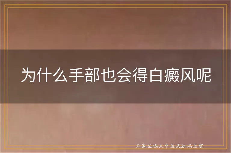 为什么手部也会得白癜风呢