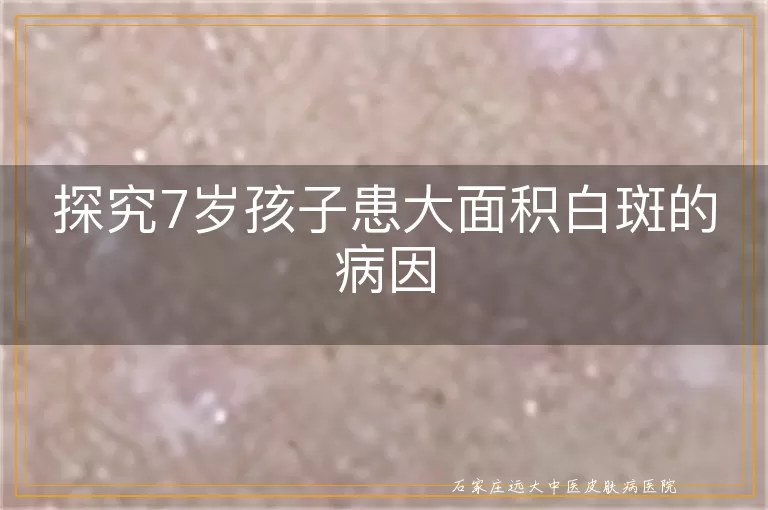 探究7岁孩子患大面积白斑的病因