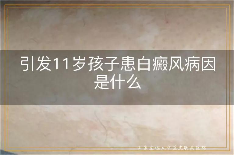 引发11岁孩子患白癜风病因是什么