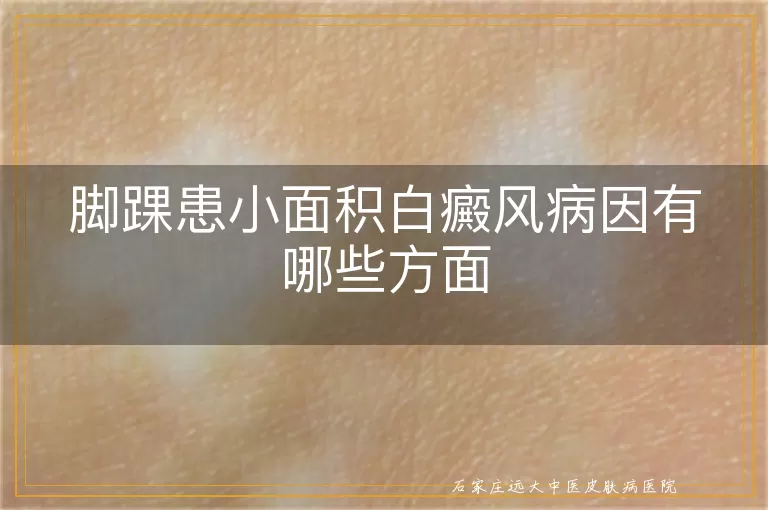 脚踝患小面积白癜风病因有哪些方面