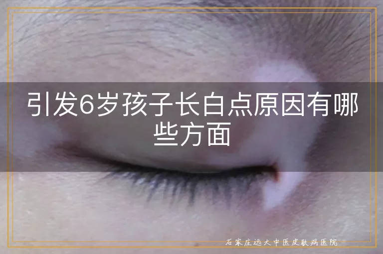 引发6岁孩子长白点原因有哪些方面