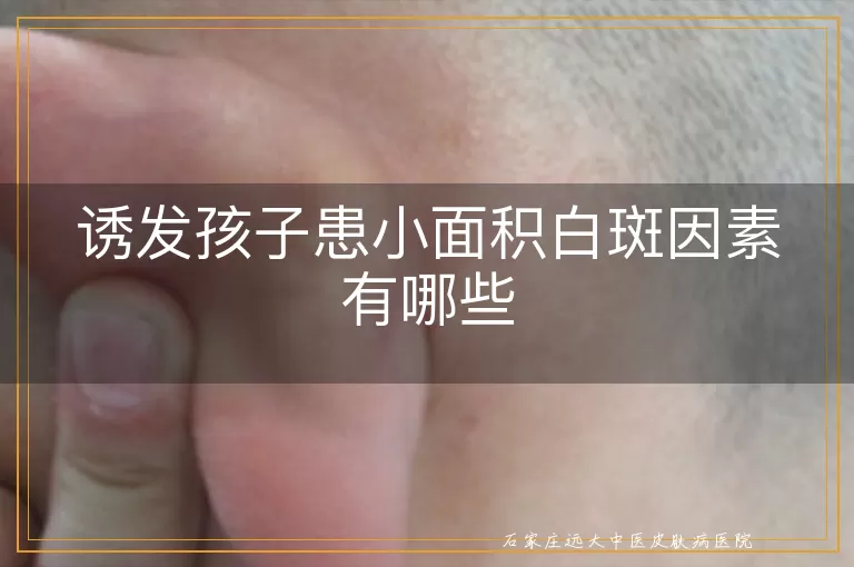 诱发孩子患小面积白斑因素有哪些