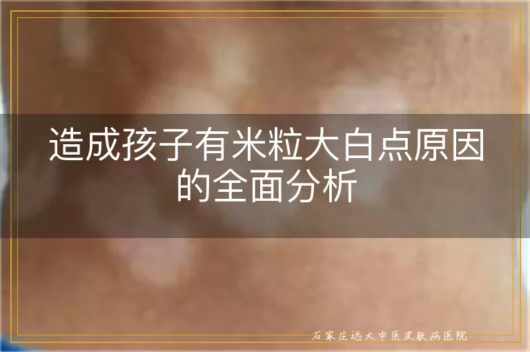 造成孩子有米粒大白点原因的全面分析