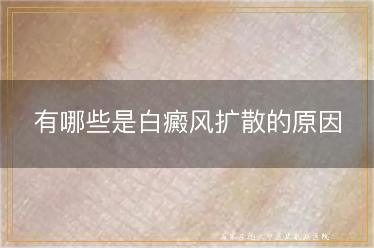 有哪些是白癜风扩散的原因