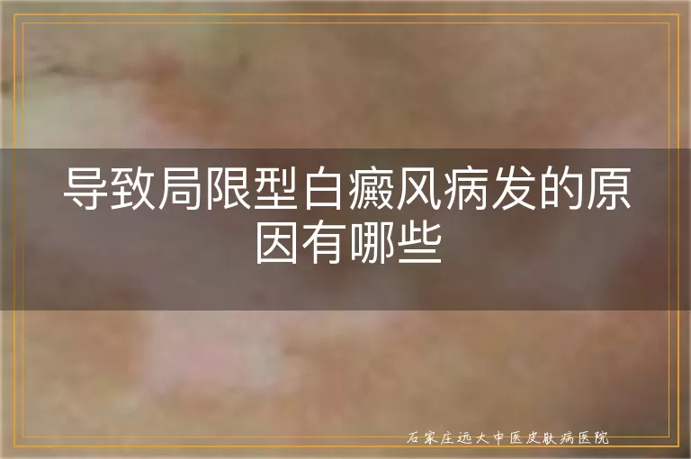 导致局限型白癜风病发的原因有哪些
