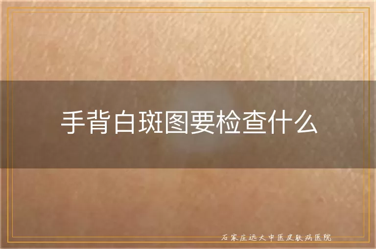 手背白斑图要检查什么