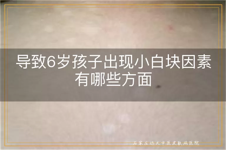 导致6岁孩子出现小白块因素有哪些方面