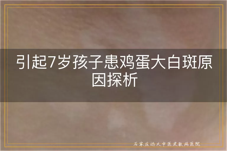 引起7岁孩子患鸡蛋大白斑原因探析