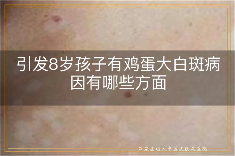 引发8岁孩子有鸡蛋大白斑病因有哪些方面