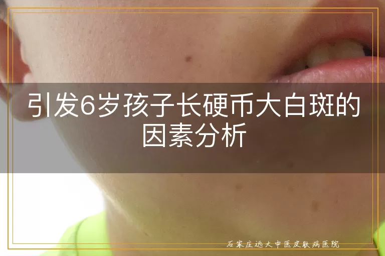 引发6岁孩子长硬币大白斑的因素分析