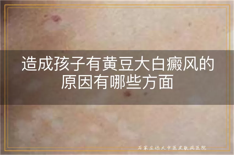造成孩子有黄豆大白癜风的原因有哪些方面