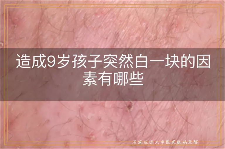 造成9岁孩子突然白一块的因素有哪些